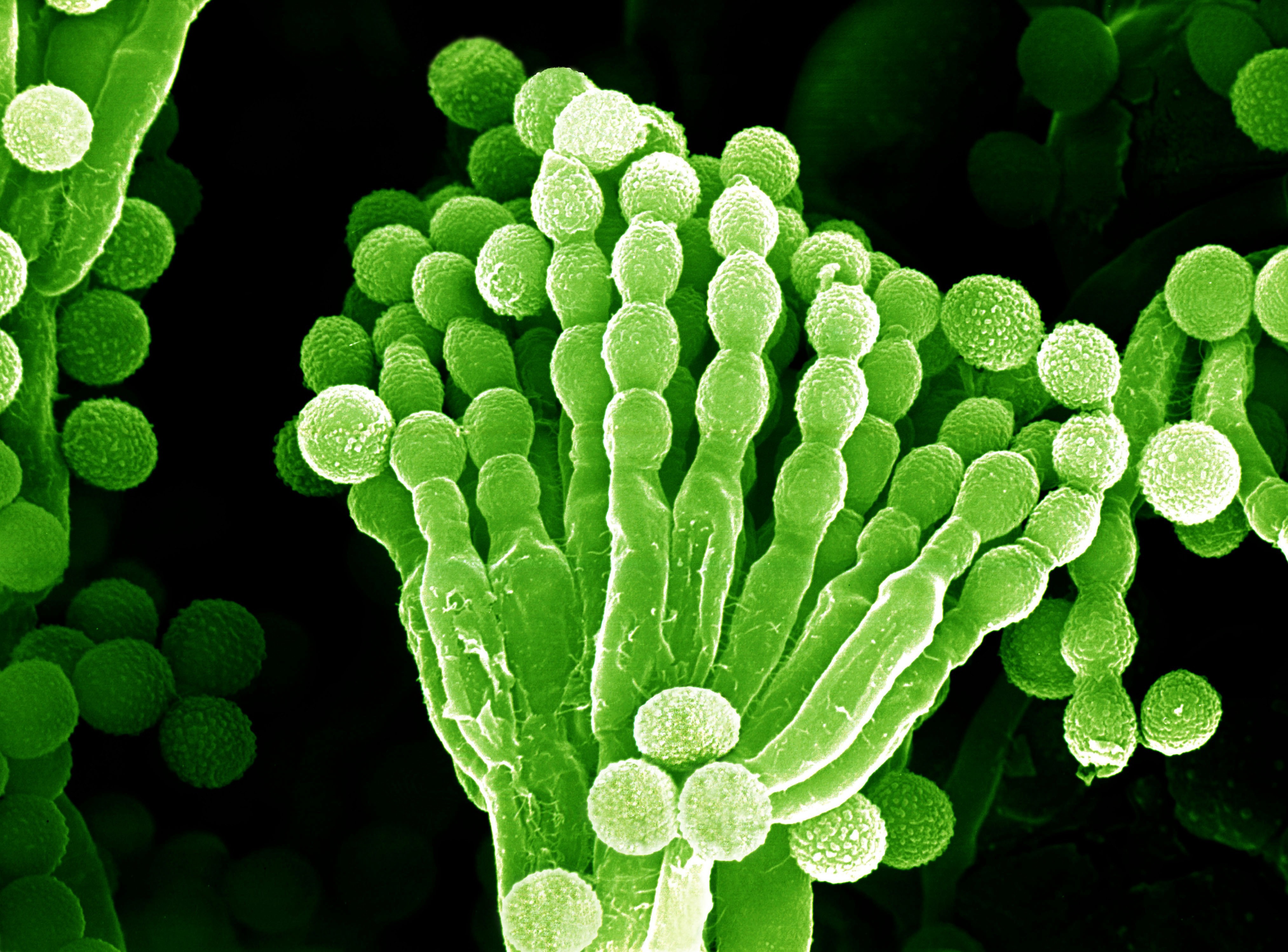 Грибы споры в организме. Плесневый гриб пеницилл. Пенициллин плесневый гриб. Пенициллиум нотатум. Гриб пеницилл в микроскопе.